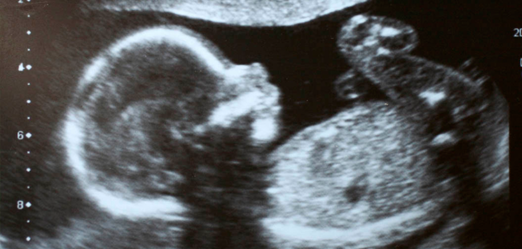 ultrasound-1