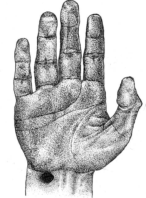 nails wrist